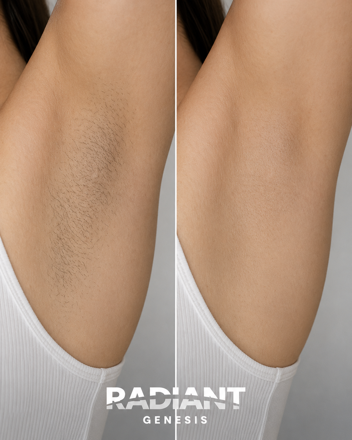 Hair Removal before and after — result 1